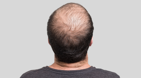 How Does Low Iron Affect Men?
